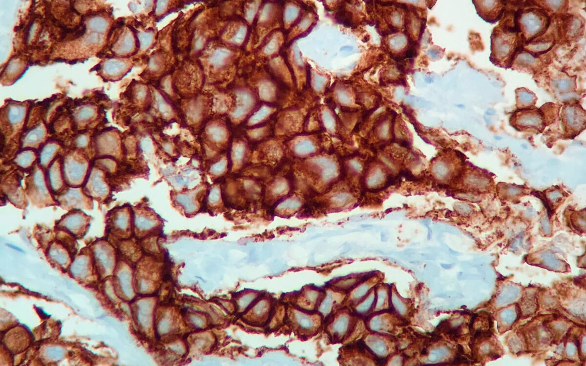 gamapath Laboratorio de patologia inmunohistoquimica